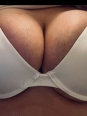 Photo #1